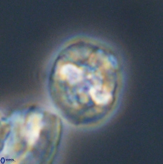 Prediscosphaera majungae 41487