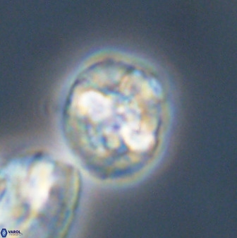 Prediscosphaera majungae 41488