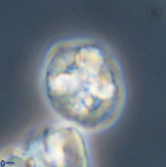 Prediscosphaera majungae 41489