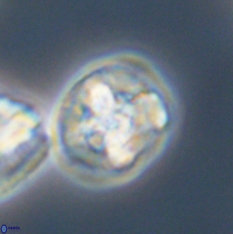 Prediscosphaera majungae 41490