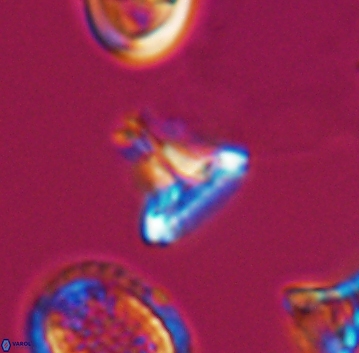 Prediscosphaera majungae 9903