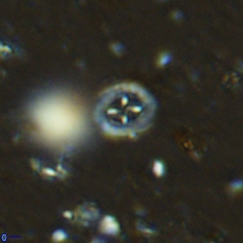 Prediscosphaera mgayae VR 15164
