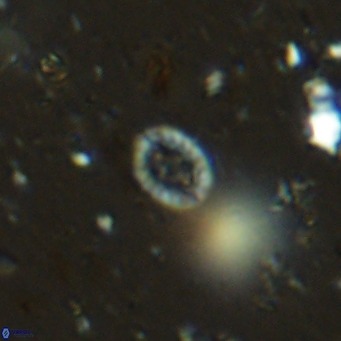 Prediscosphaera mgayae VR 15166