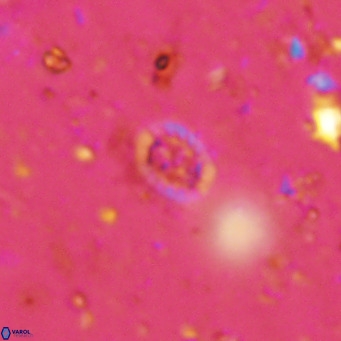 Prediscosphaera mgayae VR 15167