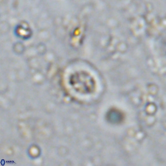 Prediscosphaera mgayae VR 15168