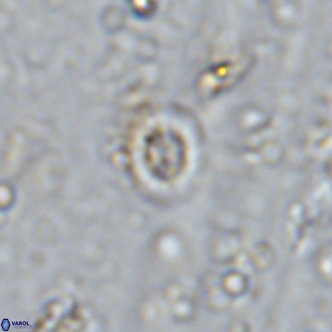 Prediscosphaera mgayae VR 15169