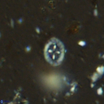 Prediscosphaera mgayae VR 15160