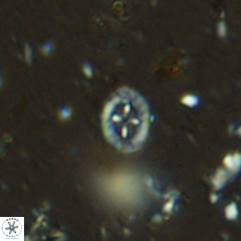 Prediscosphaera mgayae VR 15160