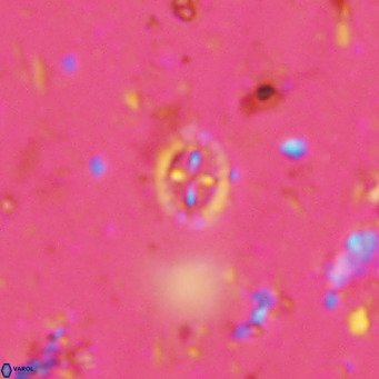 Prediscosphaera mgayae VR 15161