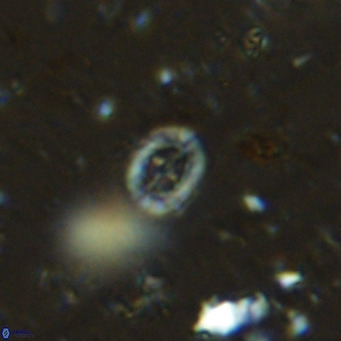 Prediscosphaera mgayae VR 15162