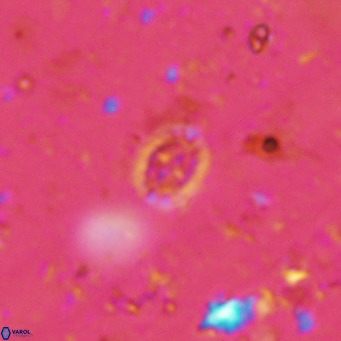 Prediscosphaera mgayae VR 15163