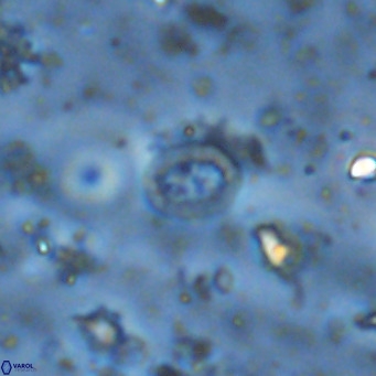 Prediscosphaera mgayae VR 15174