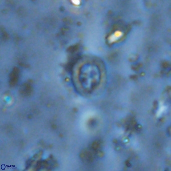 Prediscosphaera mgayae VR 15176