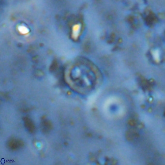 Prediscosphaera mgayae VR 15177