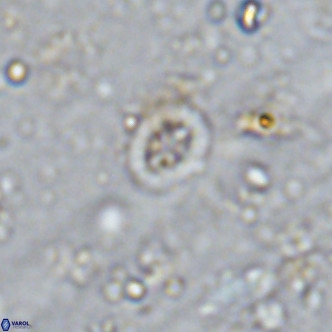 Prediscosphaera mgayae VR 15170