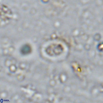 Prediscosphaera mgayae VR 15171