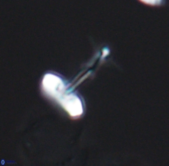 Prediscosphaera sp 8612