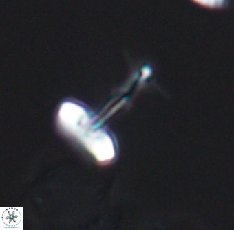 Prediscosphaera sp 8612