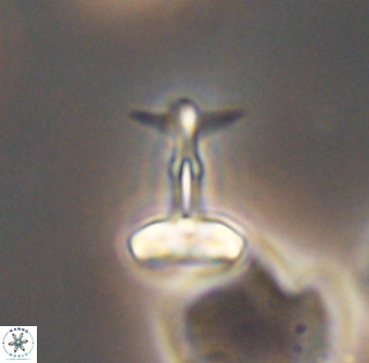 Prediscosphaera sp 8613
