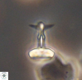 Prediscosphaera sp 8614