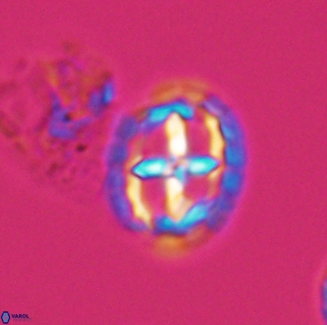 Prediscosphaera spinos 9958