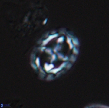 Prediscosphaera spinos 9959