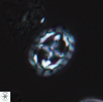 Prediscosphaera spinos 9959