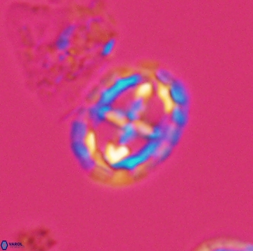 Prediscosphaera spinos 9960