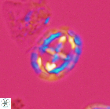 Prediscosphaera spinos 9960