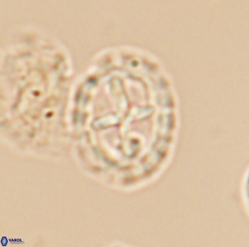 Prediscosphaera spinos 9961