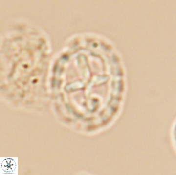 Prediscosphaera spinos 9961