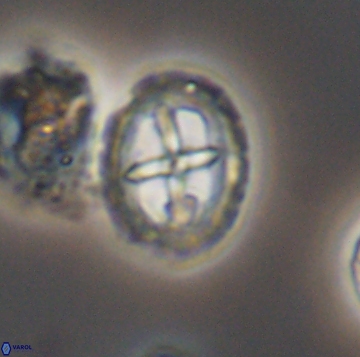 Prediscosphaera spinos 9962