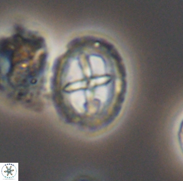 Prediscosphaera spinos 9962
