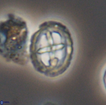Prediscosphaera spinos 9963