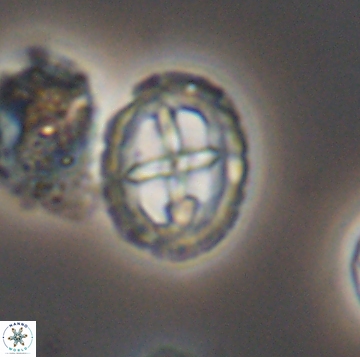 Prediscosphaera spinos 9963