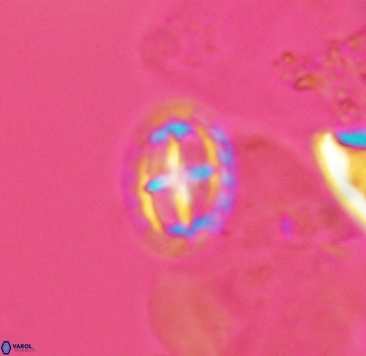 Prediscosphaera spinosa 4040