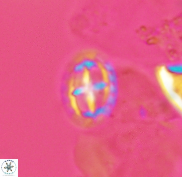 Prediscosphaera spinosa 4040