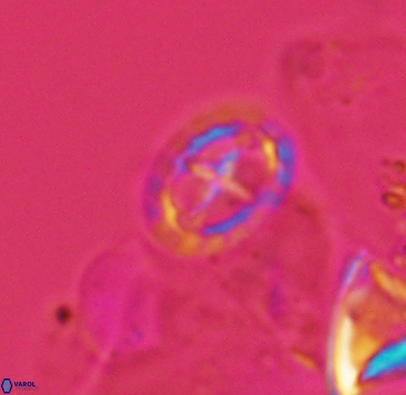 Prediscosphaera spinosa 4041