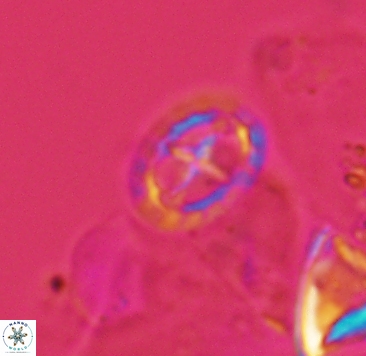 Prediscosphaera spinosa 4041