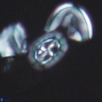 Prediscosphaera spinosa 6444