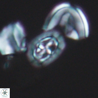 Prediscosphaera spinosa 6444