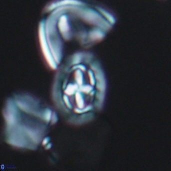 Prediscosphaera spinosa 6443