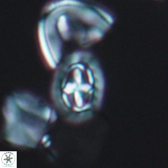 Prediscosphaera spinosa 6443