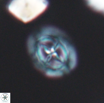 Prediscosphaera spinosa 6457
