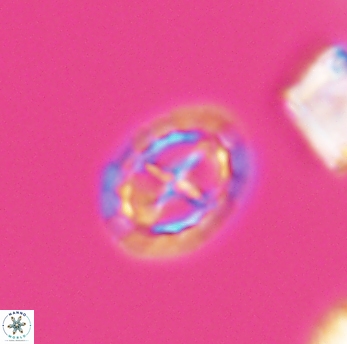 Prediscosphaera spinosa 6464