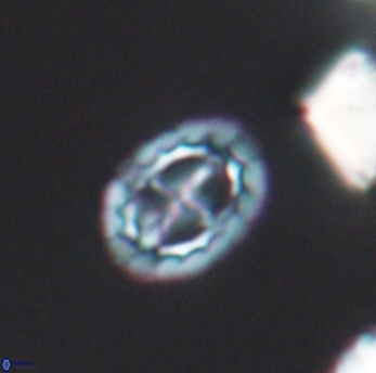 Prediscosphaera spinosa 6465