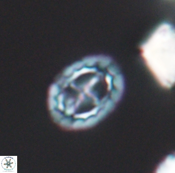 Prediscosphaera spinosa 6465
