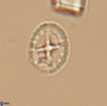 Prediscosphaera spinosa 6466
