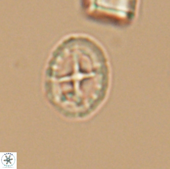 Prediscosphaera spinosa 6466