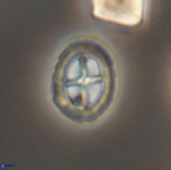 Prediscosphaera spinosa 6467
